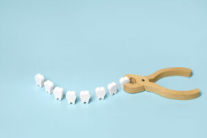 The image shows a line of fake teeth after extraction and represents the signs your wisdom teeth should be extracted.
